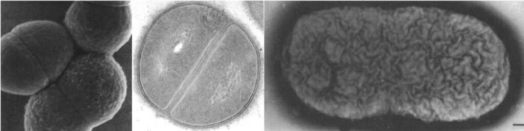 Various EMs of bacterial cells