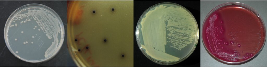 Growth of bacteria on various plates